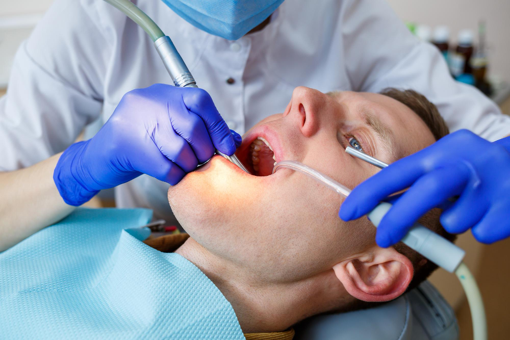 Dental Fillings