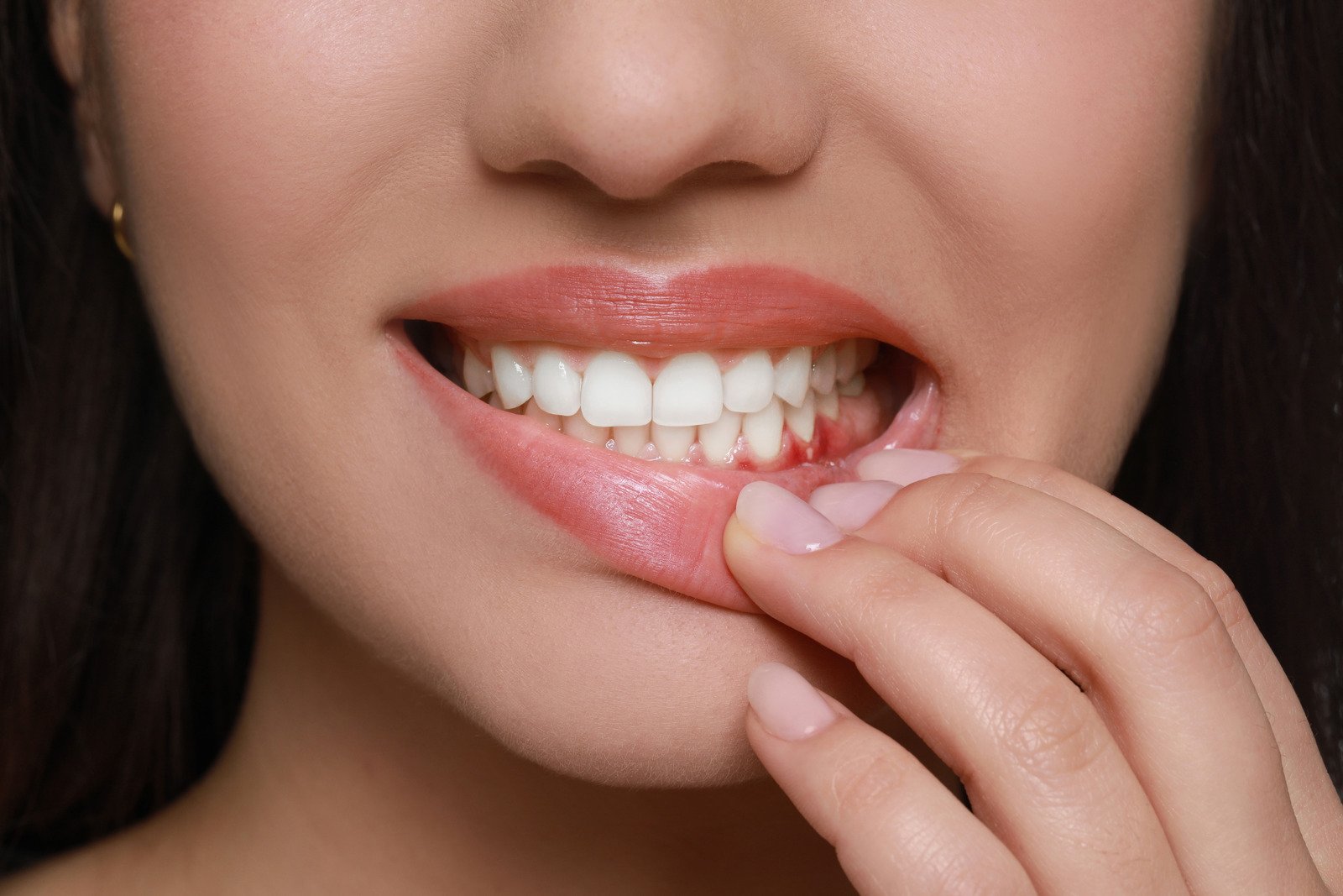 Periodontal Gum Disease Treatment